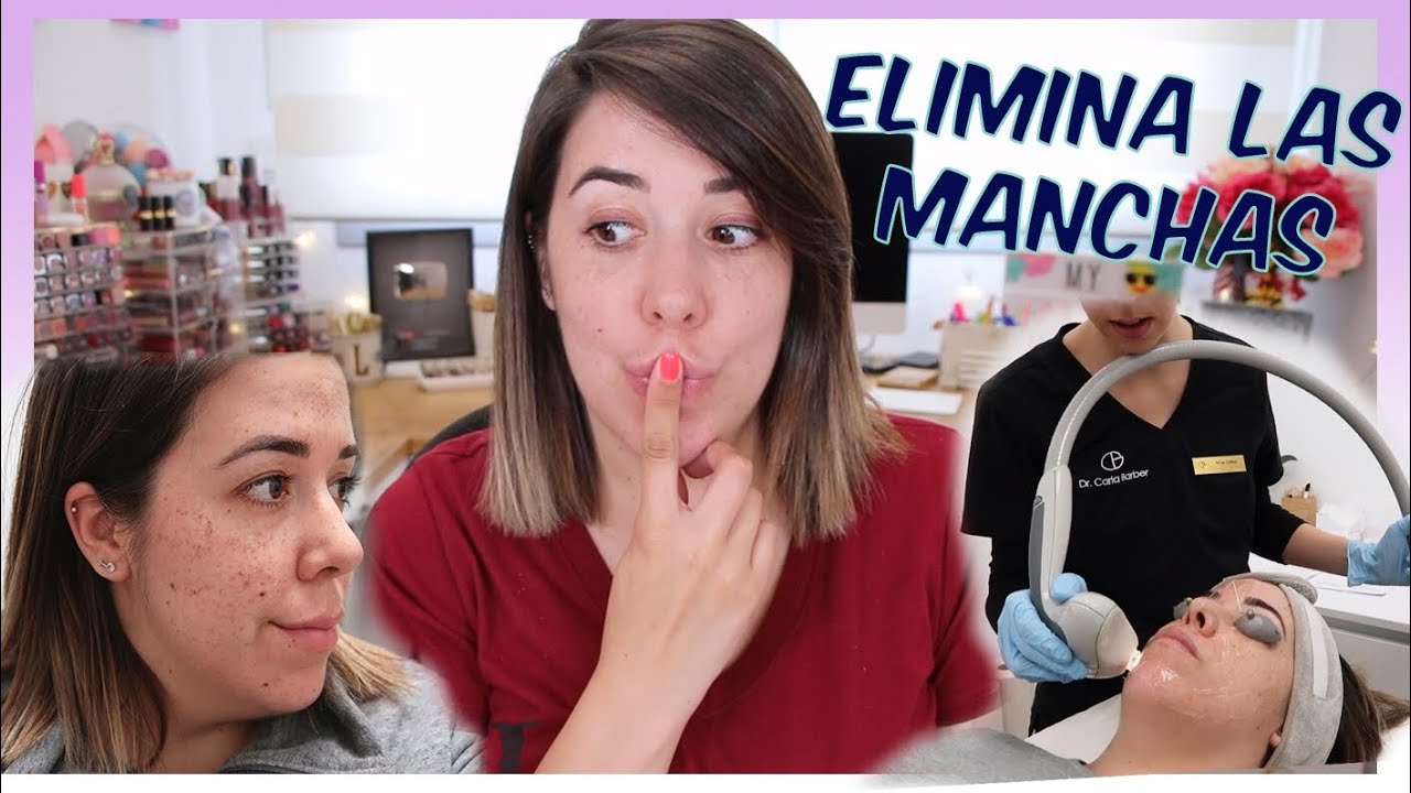 Watch LÁSER PARA ELIMINAR LAS MANCHAS DE LA PIEL | MI EXPERIENCIA Now LÁSER PARA ELIMINAR LAS MANCHAS DE LA PIEL | MI EXPERIENCIA