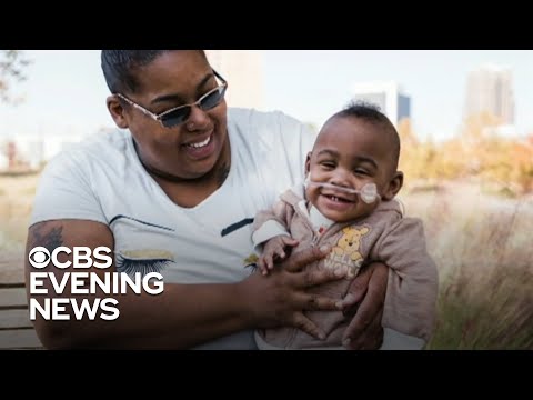 Baby named world's most premature infant to survive