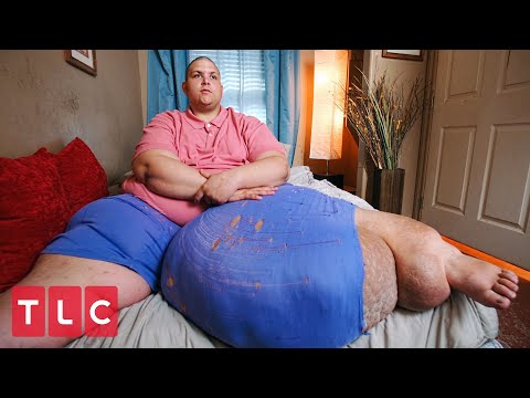 , title : 'He Carries a 100-lb Mass On His Leg! | My 600-lb Life'