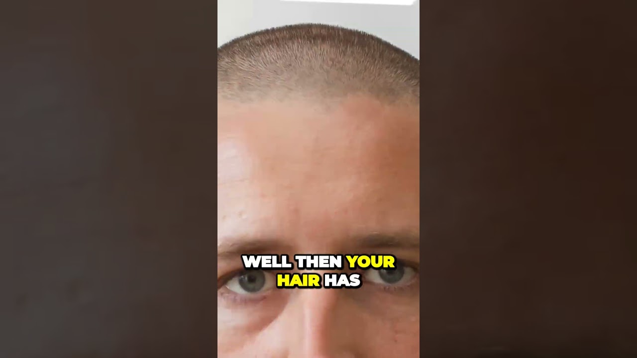 Reverse Hair Loss Unlock the Secret to Thick Luscious Hair