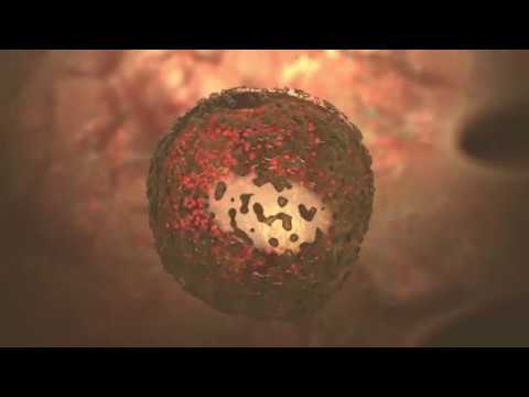 Entamoeba histolytica