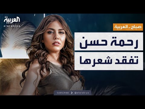 فيديو | صباح العربية | فنانة مصرية تفاجئ الجمهور: "شعري وقع كله"