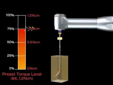 Endomotors - Auto Reverse Function | pinkblue