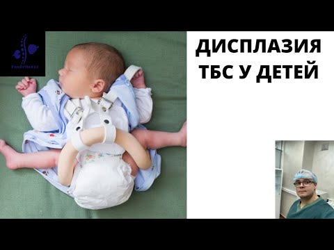 Дисплазия тазобедренного сустава у детей!!! Детский ортопед и здоровье суставов