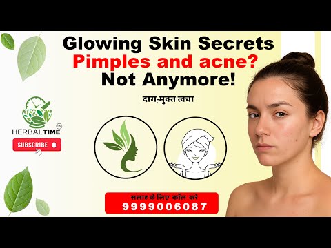 Acno Safe Cream