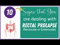 10 Signs That You Are Dealing With Rectal Prolapse Rectocele