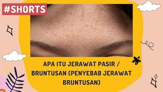 Download lagu Apa Itu Jerawat Pasir / Beruntusan - (Penyebab Beruntusan) mp3