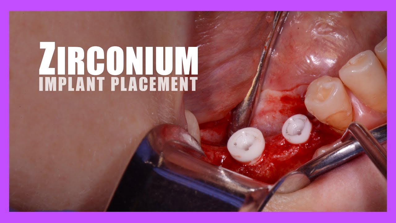 Surgical Technique 2