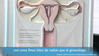 DIU e implantes en el Centro Clínico Betanzos 60 - Juan Antonio Perea Ortiz