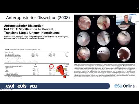 My talk on the ESU Webinar on enucleation of the prostate