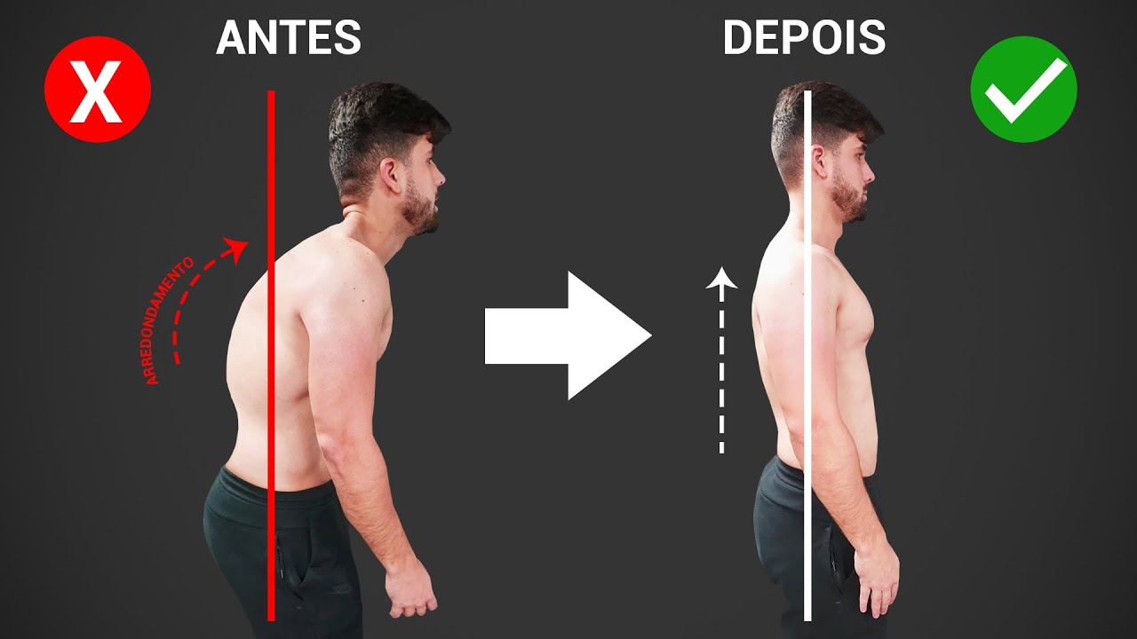 Como corrigir os ombros rodados. / Somente 5 MINUTOS!