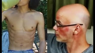 Vegans: The Epitome of Malnourishment