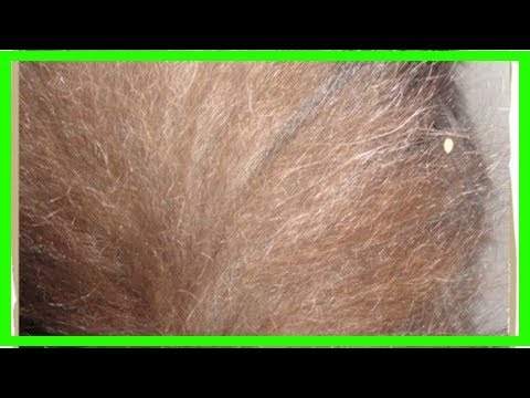 How to identify, treat, and prevent tapeworms in cats - YouTube