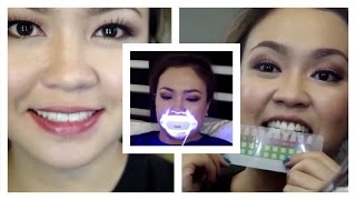 Paano Ako:  Teeth Whitening Routine