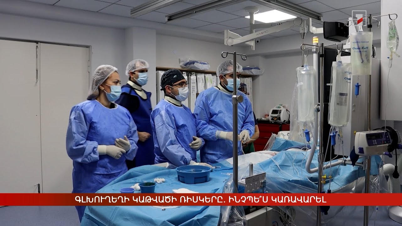 Գլխուղեղի կաթվածի ռիսկերը. ինչպե՞ս կառավարել