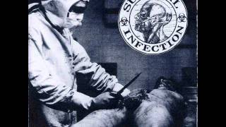 Surgical Infection - Human Puzzle (Mortician Cover)