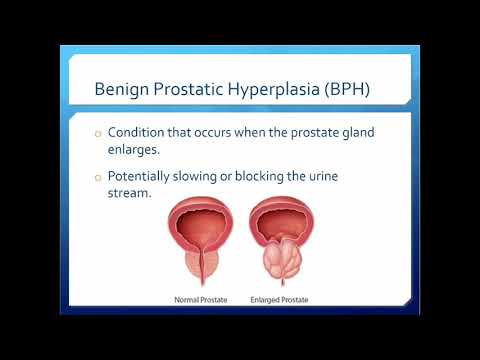 A prostatitis urethritis után