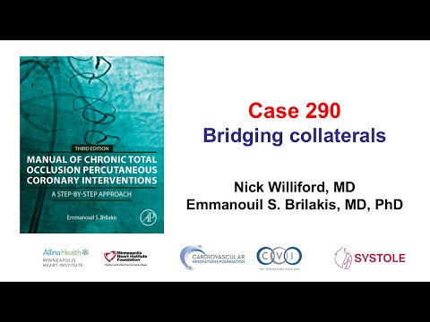 Case 290: Manual of CTO PCI - Bridging collaterals