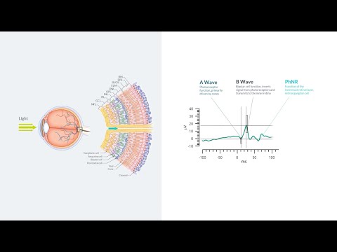 RETeval: The ERG Waveform