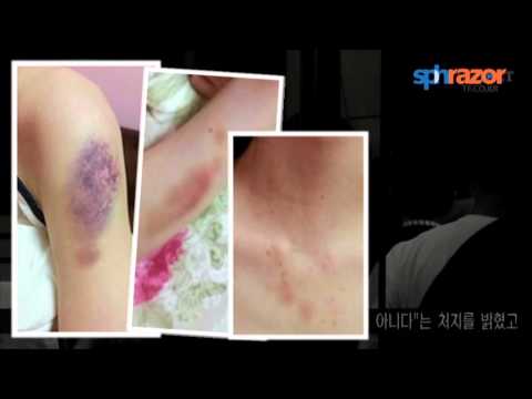 Kim Hyun Joong admits he hit girlfriend