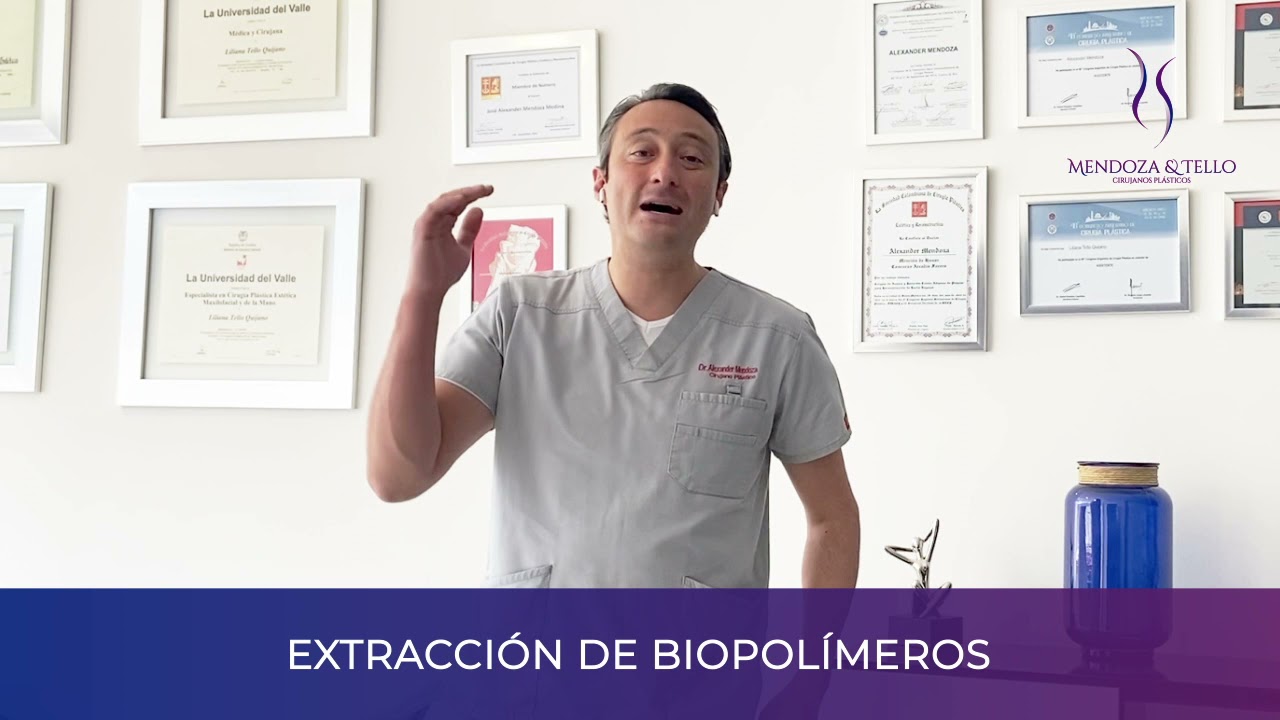 Alexander Mendoza-115