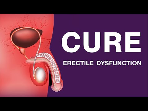 Shockwave Therapy for Erectile Dysfunction (ED) and Electromagnetic transduction treatment. (EMTT),