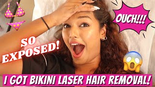 I got Bikini Laser Hair Removal | DONE AT HOME! Insane results😱