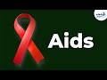 What Is HIV And AIDS Transmission Prevention Treatment Infectious Diseases Don T Memorise