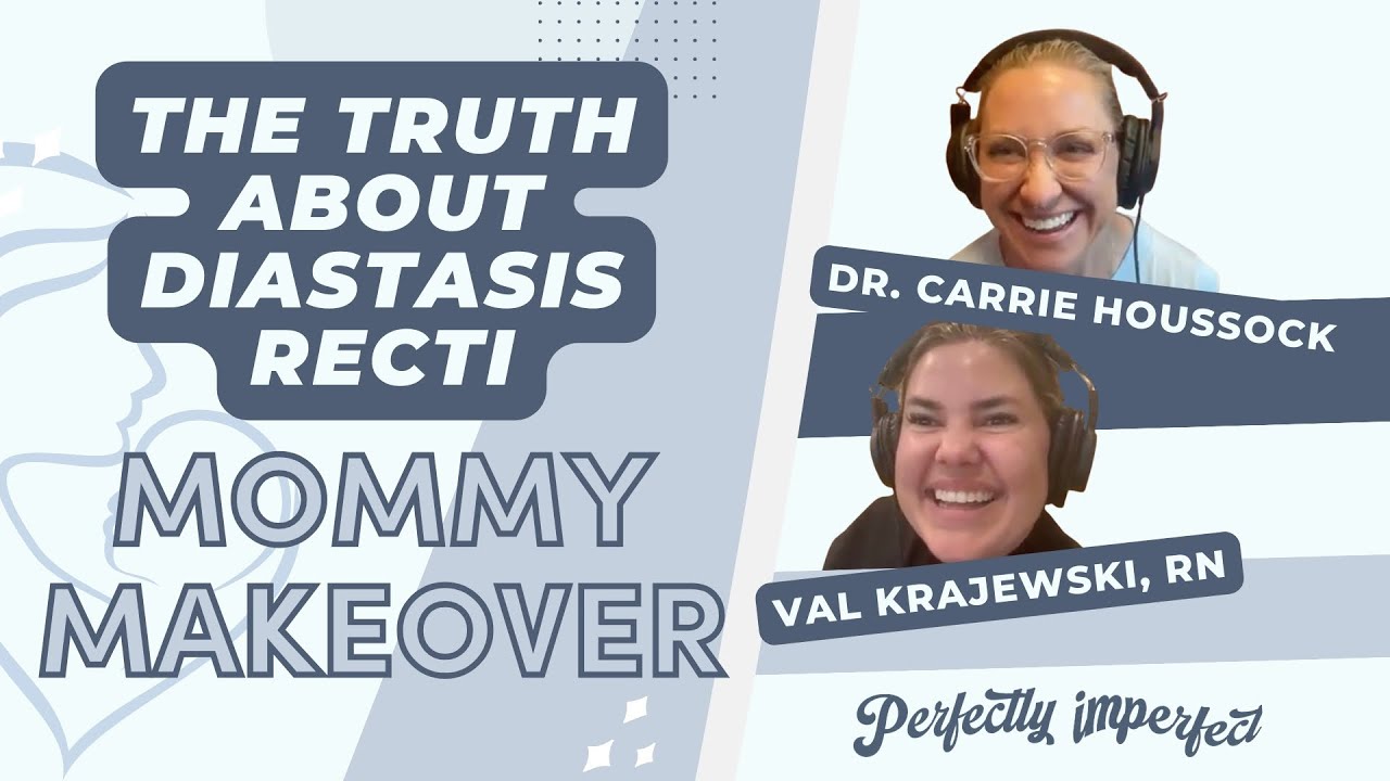 Mommy Makeover: The Truth About Diastasis Recti