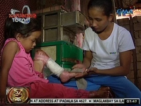 Pagtatae pagkatapos kumain slimming Pagkain slimming cream sopas recipe