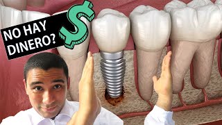 No tienes dinero para el IMPLANTE DENTAL después de la ortodoncia🦷 hay una solución!!😎