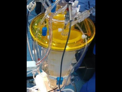 Oxygen Concentrator