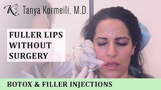 Fuller Lips without Surgery