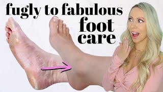 ULTIMATE AT HOME FOOT CARE! *Feet Transformation*