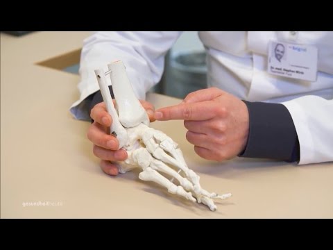 Osteochondrose essen sollten Foto Übungen für Halswirbelsäule