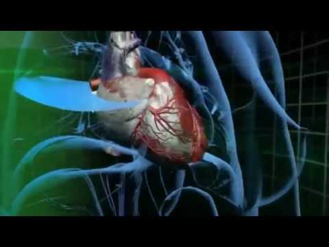 ReverseYourAge - Jeunesse® Global ProPectin™ Apple Pectin binds with Cesium 137