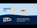Sexual Health Syphilis Male