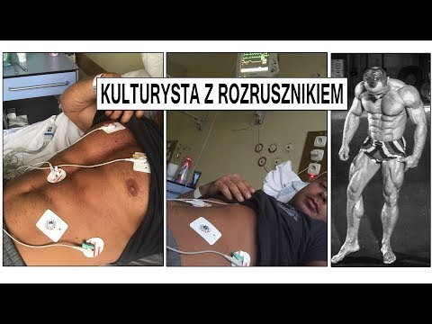 Uczucie pieczenia w mięśniach nóg przyczyn Kinesis TEIP jak prawidłowo umieścić na mięśnie łydki