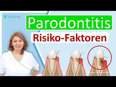 Parodontose: Welche Patienten haben ein erhöhtes Risiko zu erkranken? Zahnarzt Großostheim