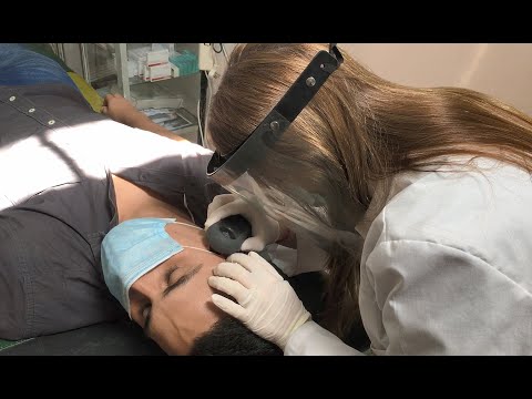 Concluye la campaña de detección de cáncer de piel en el hospital Señor del Milagro