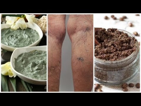 Gelenkrheumatismus, die Behandlung von Knie-TEP, wo es besser zu machen