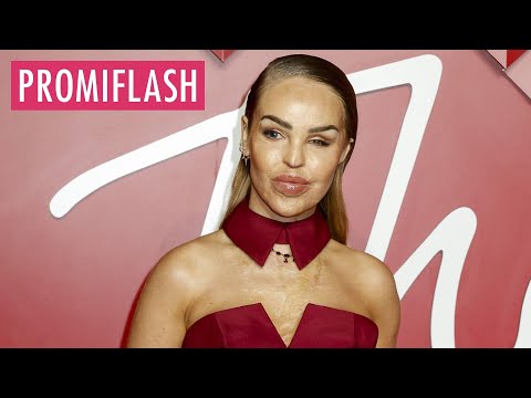 Katie Piper macht überraschendes Geständnis über ihre Ehe