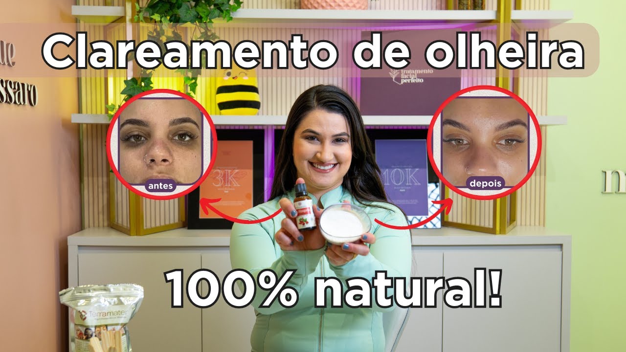 Protocolo para clareamento de olheiras 100% natural