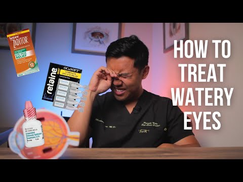 Watery Eyes? How to treat watery eyes 😢 Ophthalmologist @michaelchuamd