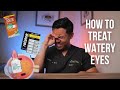 Watery Eyes? How to treat watery eyes 😢 Ophthalmologist @michaelchuamd