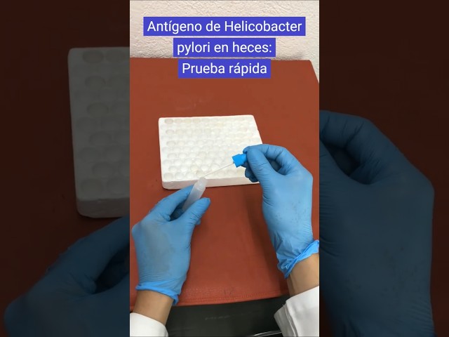 Vídeo relacionado con Home H. Pylori - Kit de comprobación de detección, 2 unidades, resultados en 3 minutos, fácil autocomprobación en 3 pasos, guía multilingüe (idioma español no garantizado)