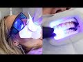 Is Professional Teeth Whitening Really Worth It Celebrity Dentist Spills All Glam Lab