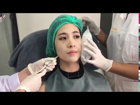 โบท็อก ที่ไหนดี