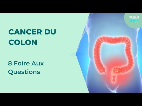 CANCER DU COLON