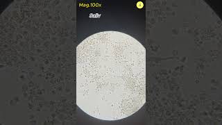 100 million bacteria per 1ml of saliva | TULO - Microscope #shorts #bacteria #saliva